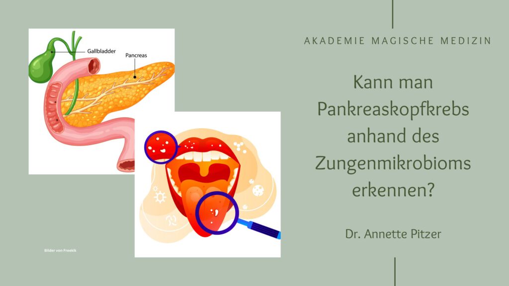 Akademie magische Medizin
Pankreaskopfkrebs und Zungenmikrobiom